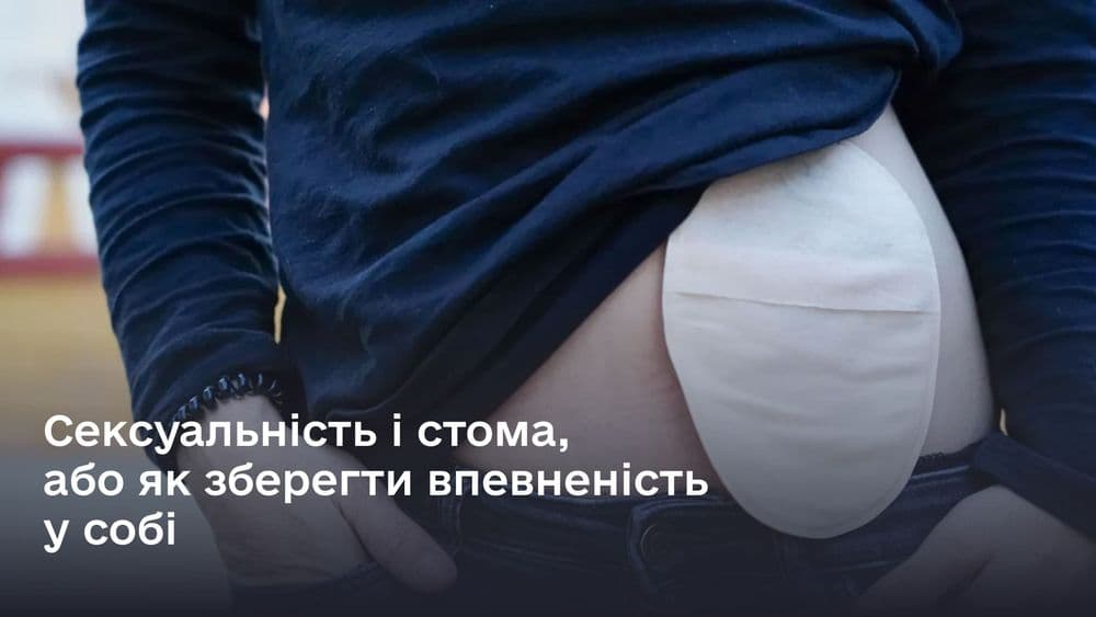Сексуальність і стома, або як зберегти впевненість у собі